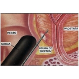 cirurgia de postectomia em adultos Vila Dalila