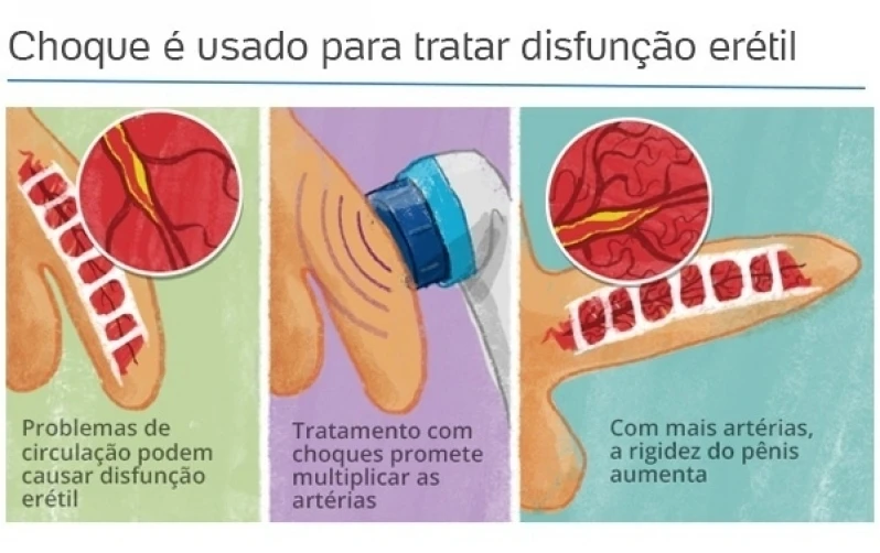 tratamento para impotência