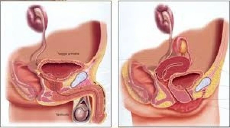 tratamento para incontinência urinaria