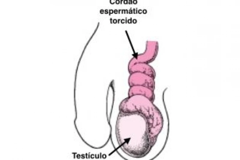 urologista com urgência