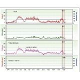 avaliação urodinâmica na Cidade Líder