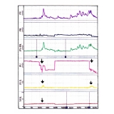 biopsia de próstata em SP preço em Itaquera
