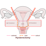 cirurgia de fimose Belém cirurgia de fimose Belém
