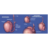 cirurgia fimose parcial particular Diadema cirurgia fimose parcial particular Diadema