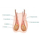 cirurgia para remoção fimose particular Ponte Rasa cirurgia para remoção fimose particular Ponte Rasa