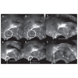 cirurgias-de-postectomia-cirurgia-de-fimose-postectomia-cirurgia-de-postectomia-cirurgia-sao-caetano-do-sul