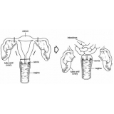 clínica de cirurgia fimose adulto Água Rasa clínica de cirurgia fimose adulto Água Rasa