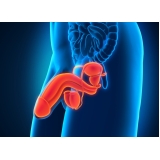 clínica de urologia em São Paulo onde encontrar no Itaim Paulista clínica de urologia em São Paulo onde encontrar no Itaim Paulista
