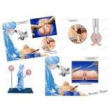 clínica para cirurgia fimose parcial São Bernardo do Campo clínica para cirurgia fimose parcial São Bernardo do Campo