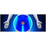 clinicas-de-urologia-andrologia-clinica-de-andrologia-em-sp-em-agua-rasa
