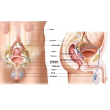 clínicas particulares de urologia na Ponte Rasa clínicas particulares de urologia na Ponte Rasa