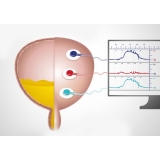 estudo urodinâmico em Água Rasa