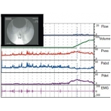 onde encontrar biopsia para detectar câncer de próstata em José Bonifácio
