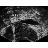 onde encontrar biópsia prostática de saturação na Vila Matilde