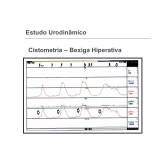 onde encontrar estudo urodinâmico no Parque São Rafael