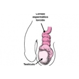 onde encontro urologista particular no Jardim Iguatemi onde encontro urologista particular no Jardim Iguatemi