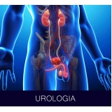 onde encontro urologista em São Caetano do Sul onde encontro urologista em São Caetano do Sul