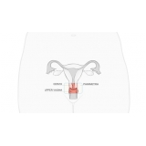 onde faz cirurgia de fimose completa Jardim Iguatemi onde faz cirurgia de fimose completa Jardim Iguatemi