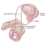 onde fazer cirurgia da fimose Cidade Líder onde fazer cirurgia da fimose Cidade Líder