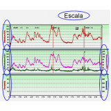 quanto custa avaliação urodinâmica na Vila Dalila