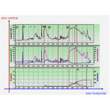 quanto custa biopsia para detectar câncer de próstata no Parque do Carmo