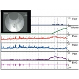 quanto custa estudo urodinâmico no Parque São Rafael