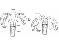 vasectomia-cirurgia-de-vasectomia-em-sao-paulo-cirurgia-de-vasectomia-em-sp-em-aricanduva