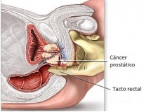 tratamento-urologico-biopsia-peniana-biopsia-peniana-na-vila-re