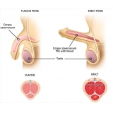 tratamento-urologico-biopsia-peniana-cauterizacao-peniana-em-diadema