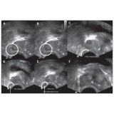ultrassonografia de próstata em São Bernardo do Campo