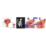 uroginecologia no Tatuapé uroginecologia no Tatuapé