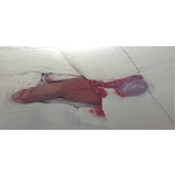 urologista particular em SP onde encontrar em Ermelino Matarazzo urologista particular em SP onde encontrar em Ermelino Matarazzo