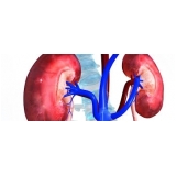 urologista particular em SP em Mauá urologista particular em SP em Mauá