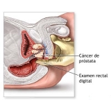 urologistas-consulta-com-urologista-especialista-em-urologia-na-vila-dalila