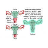 vasectomia-cirurgia-de-vasectomia-em-sao-paulo-cirurgia-de-vasectomia-preco-em-sao-bernardo-do-campo